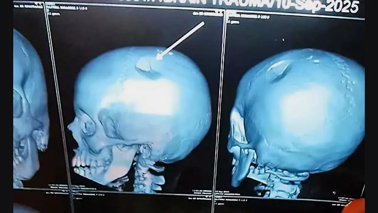 Teacher Hits Student With Lunch Box