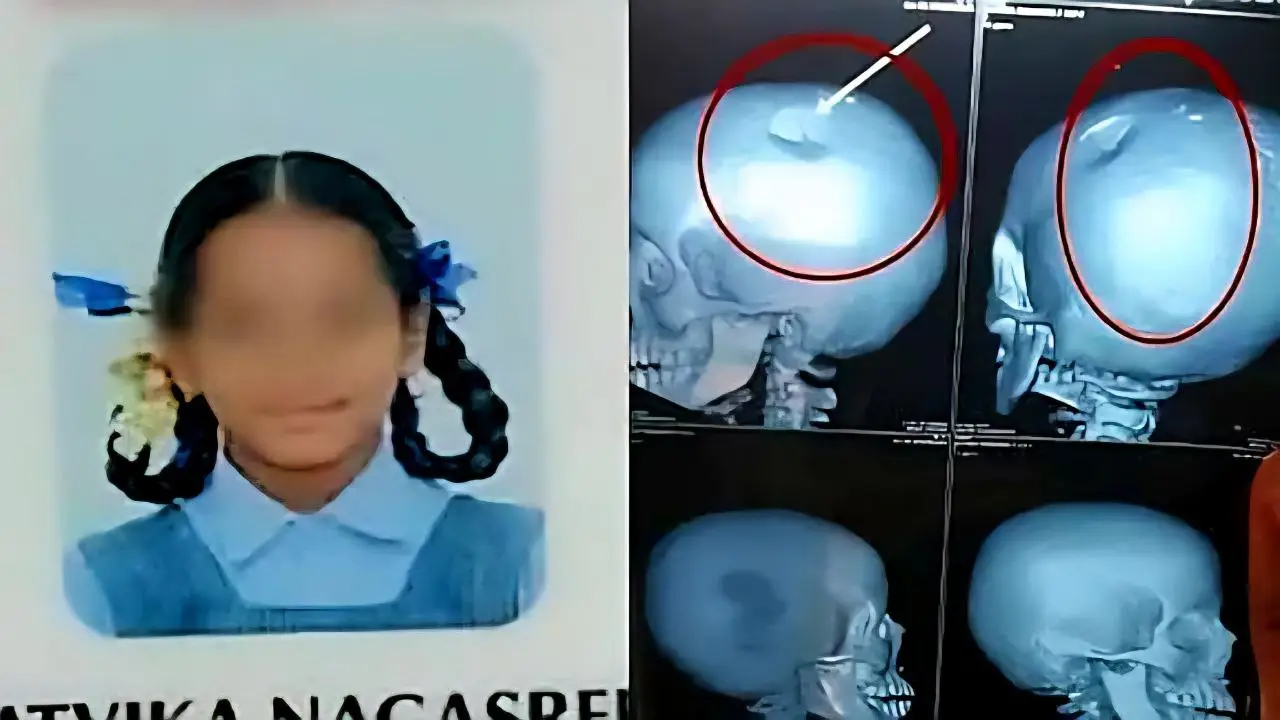 Teacher Hits Student With Lunch Box