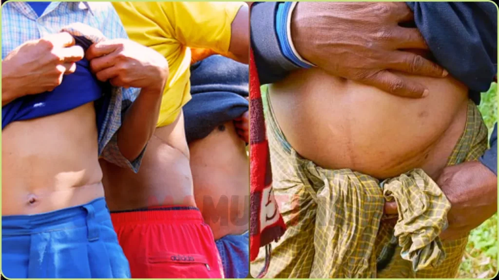 பள்ளிபாளையத்தில் சிறுநீரக மோசடி