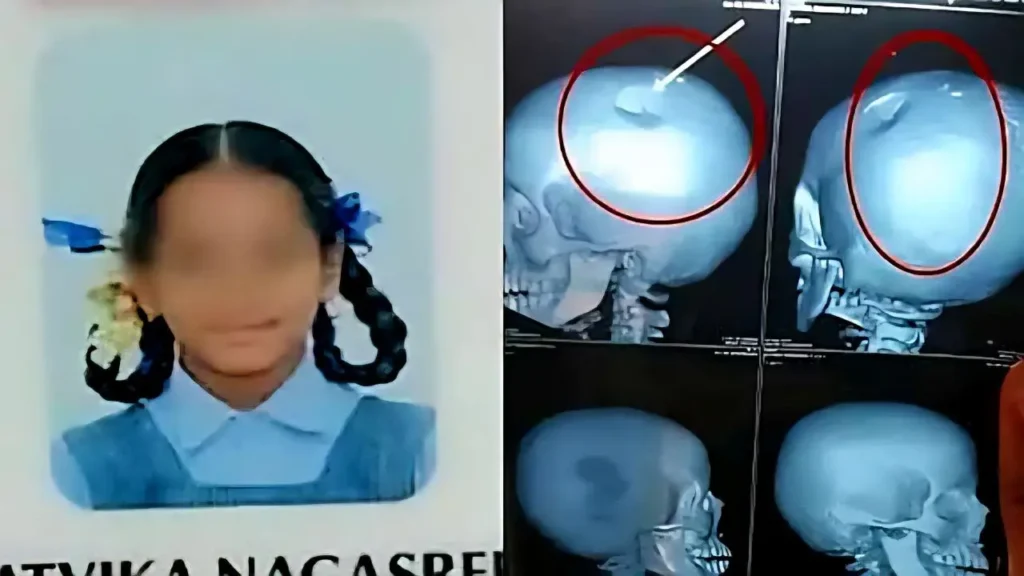 Teacher Hits Student With Lunch Box