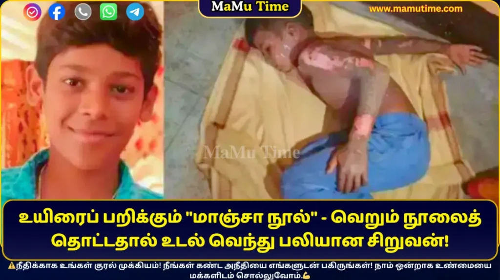 உயிரைப் பறிக்கும் மாஞ்சா நூல்